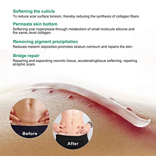 Scar Remover Cream, Reduce and Repair Skin, from CSection, Acne