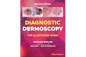Diagnostic Dermoscopy: The Illustrated Guide