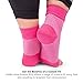 Bitly Plantar Fasciitis Socks (1 Pair) Premium Ankle Support foot Compression Sleeve (Small, Pink)