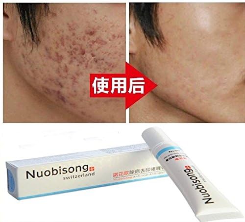 Anminlink Nuobisong Remove Scar Cream Remove Acne Spots Remove Striae Gravidarum Skin Treatment Care Anti-Aging Moisturizing 15ml