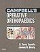 Campbell's Operative Orthopaedics: 4-Volume Set