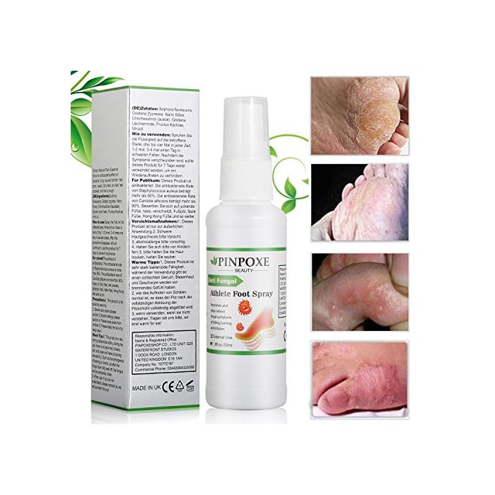 Foot Spray, Natural formula, Athletes Foot, Ringworm, Jock Itch and Foot Infections. Effectively Soothes in Minutes…