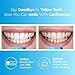 Dental Duty Teeth Whitening Kit with LED Light- 35% Carbamide Peroxide Gel Pen,14 White Strips, 2 Whitening Pens- Professional Stain Remover for Sensitive Teeth-Best Tooth Whitener, Bright White Smile