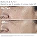 SkinMedica HA5 Rejuvenating Hydrator. Hyaluronic Acid Serum for Face with Five Types of Hyaluronic Acid that Smooth Fine Lines and Wrinkles, For All Skin Types, 1 Oz