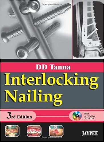 Interlocking Nailing 9788184488821 Medicine Health - 