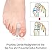Dr. Foot’s Gel Toe Separators for Hammer Toes - Flared Toe Spacers Bunion Corrector Relaxing 8 Pieces for Bunion Overlapping Toes, Bunion Toe Pain Relief