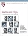 Harvard Medical School Knees and Hips: A troubleshooting guide to knee and hip pain by 