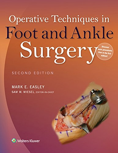 Download Operative Techniques in Foot and Ankle Surgery (English Edition) PDF