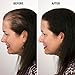 Infinity Hair Building Fibers Hair Loss Concealer for Thinning Hair & Hair Loss for Women & Men Appearance Of Thicker, Fuller Hair In 30 Seconds Kit, Dark Brown