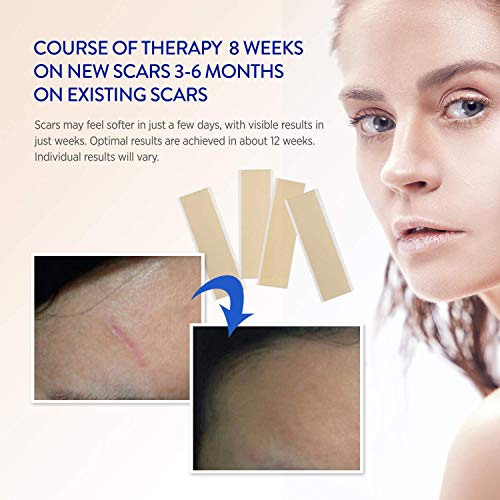 Aroamas Professional Silicone C-Section Scar Removal Sheets, Soft Adhesive Fabric Strips, Drug-Free, Relieves Itching, Remove Keloid Scars, Acne (2 Month Supply)