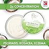 Yara-Rosacea-Psoriasis-Eczema-Natural-Moisturiser-For-Sensitive-Skin-Award-Winning-Organic-Shea-Butter-Moisturiser-and-Shea-Butter-Hand-Cream-Vegan-Body-Care-Safe-Eczema-Cream-For-Children Yara Rosacea, Psoriasis, Eczema Natural Moisturiser For Sensitive Skin | Award Winning Organic Shea Butter Moisturiser…