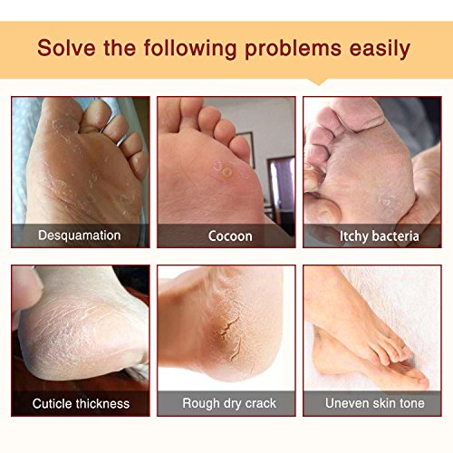 Foot Mask, 5 Pack Foot Peel Mask, Exfoliating Callus Remover, Soft Foot