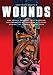 Wounds by Gary Scott Beatty