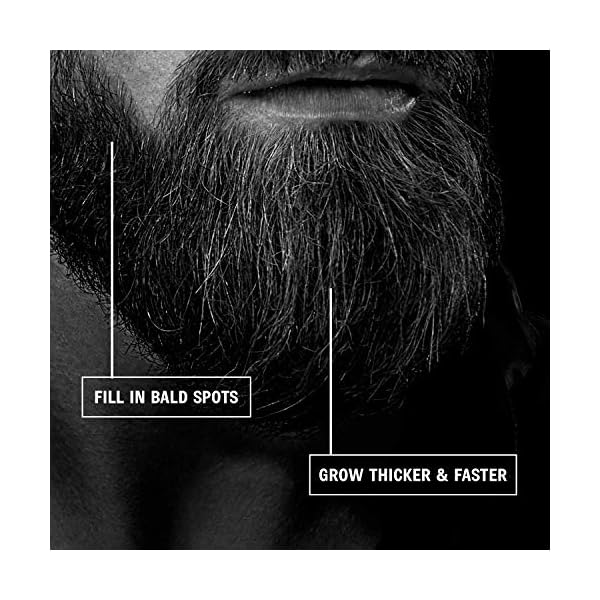 Red-Blooded Beard Growth Roller | Stimulate Beard and Hair Growth | 540 0.5mm Titanium Needles | Derma Roller For Men…