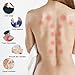 Massage Cups，Silicone Anti Cellulite Facial Cupping cups for for Body Detoxification, Joint and Muscle Soreness Relief, Cellulite Treatment, Pain Relief