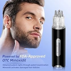 Minoxidil for Men Hair Regrowth