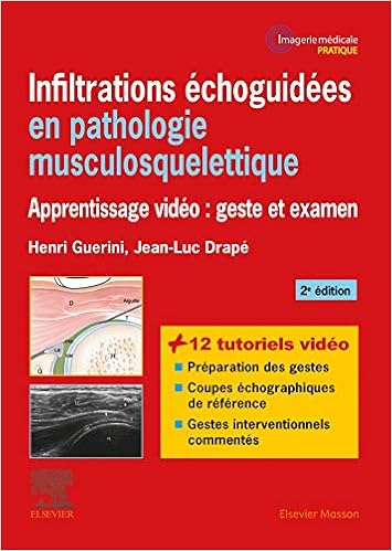 Amazon Fr Infiltrations Echoguidees En Pathologie Musculosquelettique Apprentissage Video Geste Et Examen Guerini Henri Drape Jean Luc Livres
