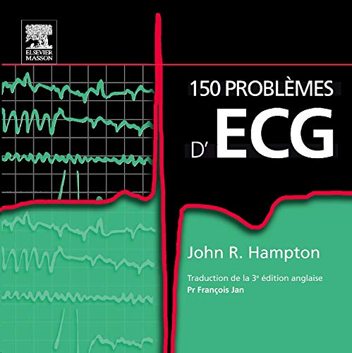 150 problèmes d'ECG by John-R Hampton