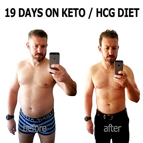 Ketone Keto Urine 150 Test Strips. 3 Resealable Foil Packs of 50 Strips Each. Look & Feel