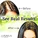 Natural Sulfate Free Hair Growth Shampoo & Conditioner Set - for Hair Loss & Thinning Hair. Natural & Organic Hair Product for Healthy Scalp.