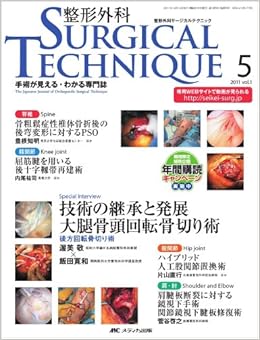 整形外科サージカルテクニック 1巻5号 本 通販 Amazon 整形外科サージカルテクニック 1巻5号 本 通販 Amazon