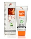 Mommy Care Anti Striae Maternity Pregnancy Stretch Marks Prevention Cellulite Treatment Cream,7.03 Ounce