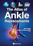 The Atlas of Ankle Replacements