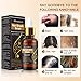 Hair Growth Serum, Hair Treatment Serum Oil, Hair Serum, Hair Growth Treatment, Stops Hair Loss, Thinning,Balding, Promotes Thicker, Fuller and Faster Growing Hair (30ML)thumb 3