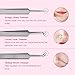Blackhead Remover Kit Tool ULG Comedone Extractor Tool Set 5Pcs Professional Stainless Steel Tweezers Kit Pimple Removal Treatment for Whitehead Blemish Acne