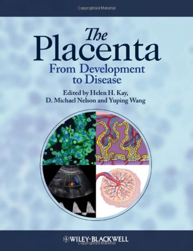 The Placenta - From Development to Disease