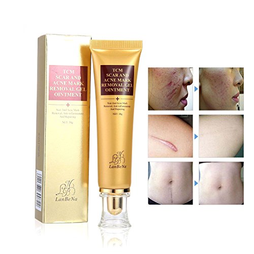 Top 10 best burn cream no scar Which is the best one in 2018