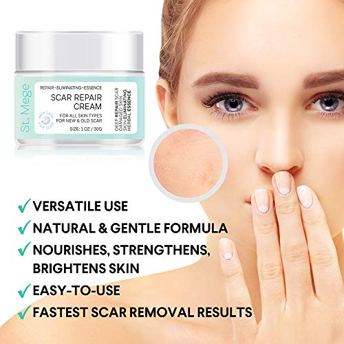 Scar Removal Cream, Scar Cream For Old Scars Stretch Mark Removal