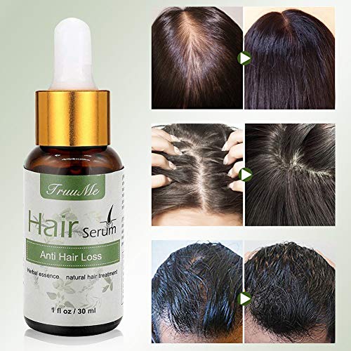Hair Growth Oil, Hair Oil for Men, Alopecia Areata Treatment, Stops Hair Loss, For Thinning Hair, Alopecia Areata, Promotes Thicker, Fuller ＆ Faster Growing - Thumbnail 5