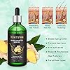Hair-Growth-Serum-100ml-Hair-Growth-Treatment-Oil-Help-Hair-Follicle-Growth-Strengthen-Hair-Roots-Thickening-Regrowth-Hair-Loss-Treatment-for-Men-Women Hair Growth Serum, 100ml Hair Growth Treatment Oil, Help Hair Follicle Growth, Strengthen Hair Roots Thickening…