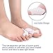Bunion Corrector Bunion Relief Protector Sleeves Kit, Big Toe Corrector Straightener Separator Treat Pain in Hallux Valgus, Big Toe Joint, Hammer Toe, Splint Aid Surgery Treatment (Blue White Splints)