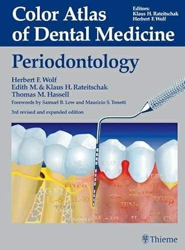 Download Color Atlas of Dental Medicine: Periodontology PDF