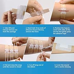 SEABIRD Emergency Wound Closure Device, Zip Sutures