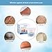 Scar Cream, Scar Treatment, Stretch Mark Cream, Scar Removal Cream, Acne Spots Treatment, Scar Cream for Face & Body, Old & New Scars from Cuts, C-Sections & Surgeries (35g)
