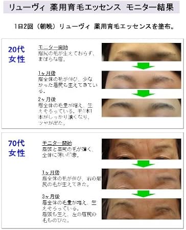 Amazon リューヴィ 薬用育毛 エッセンス 医薬部外品 2本セット 育毛 養毛 増毛 通販