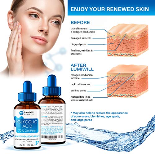 natural chemical peel