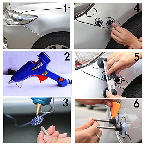 Pops a Dent Bridge Dent Puller Tool Kit, Car Dent Paintless Repair PDR