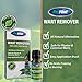 ProVent Wart Remover All Natural Topical Liquid for Plantar Wart, Flat Wart, Body Wart, Common Wart Removal, No Acids, Freezing, or Burning. Botanical Ingredients, All Skin Types .34 Fluid Ouncethumb 1