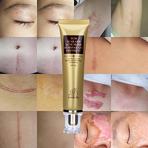 LANBENA Acne Scar Removal Cream Skin Repair Face Cream Acne Spots Treatment Anti Aging Acne Cream Blackhead Whitening Day Cream