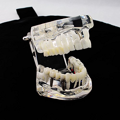 6 Dental+Teaching+Typodont+Removable+ZJ+COSM