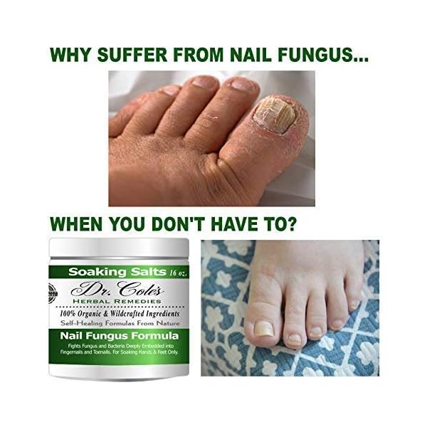 Dr. Cole’s Organic AntiFungal Hand & Foot Soaking Salts Extra