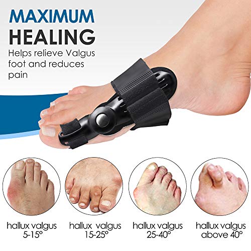Bunion Corrector Splints Foot Care Corrector Thumb Brace for Tailors Bunion and Hallux Valgus Big Bone Orthotics Toe Separators - Thumbnail 2
