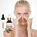 Organic Rosehip Seed Oil - Cold Pressed, Unrefined, Virgin Anti Aging Serum for Face Massage, Wrinkles, Skin, Hair and Nails