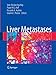 Liver Metastases by Jean-Nicolas` Vauthey, Paulo M. Hoff