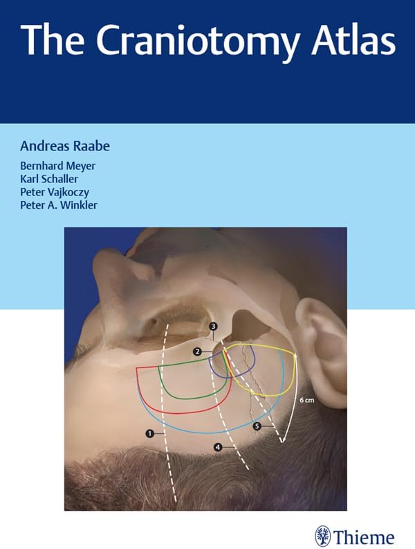 Amazon.com: Rhoton Cranial Anatomy and Surgical Approaches eBook