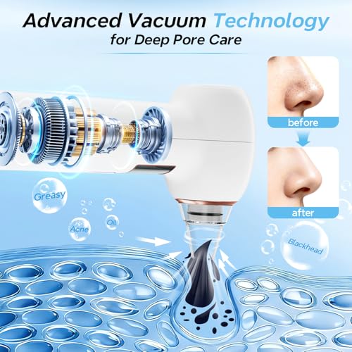 Mylzdobs Blackhead Aspirator for Facial Cleansing, Blackhead Remover with 5 Heads and 3 Suction Levels, Portable Electric Blackhead Remover with USB Charging for All Skin Types